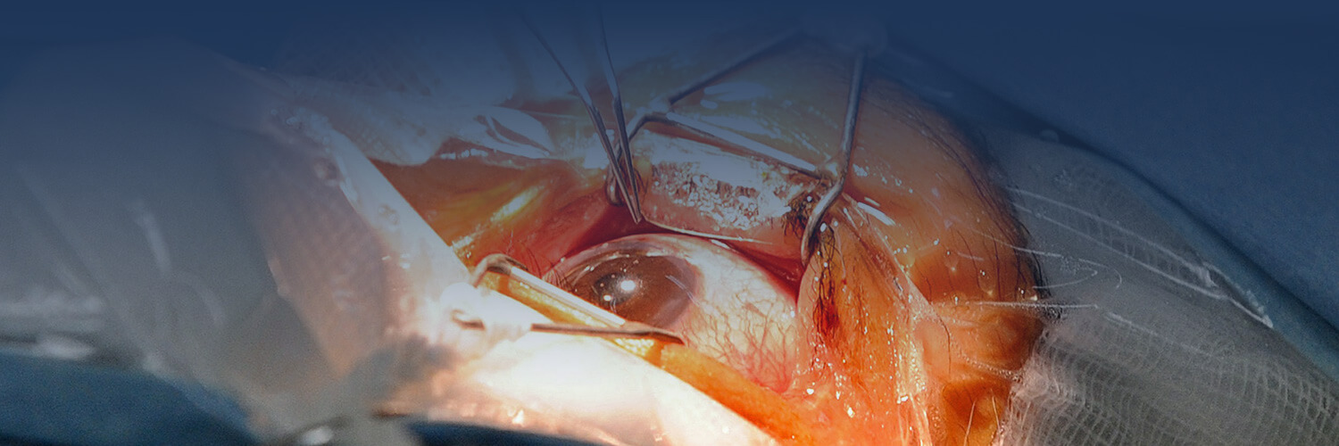 Οφθαλμική Ογκολογία 